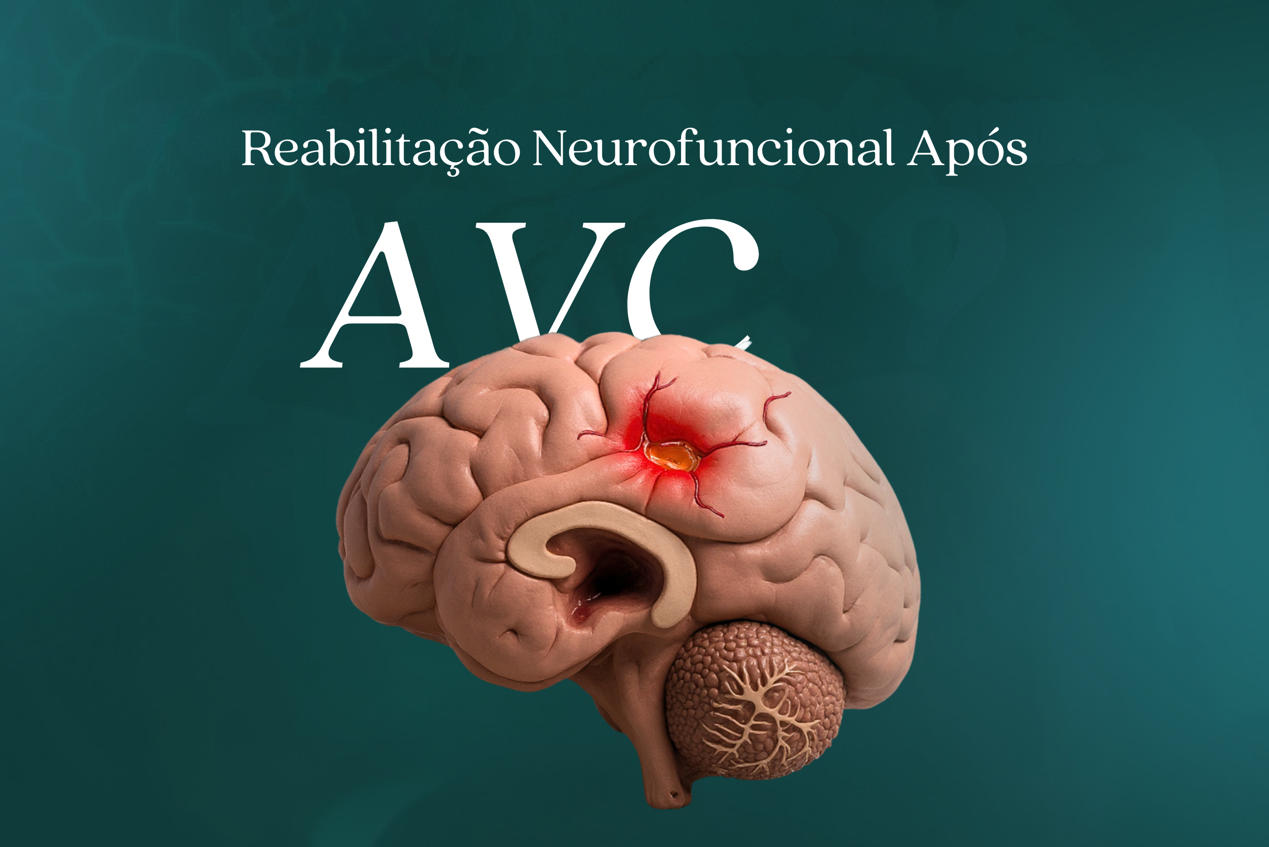 Reabilitação Neurofuncional Após Acidente Vascular Cerebral: Estratégias Integradas para Recuperação Funcional